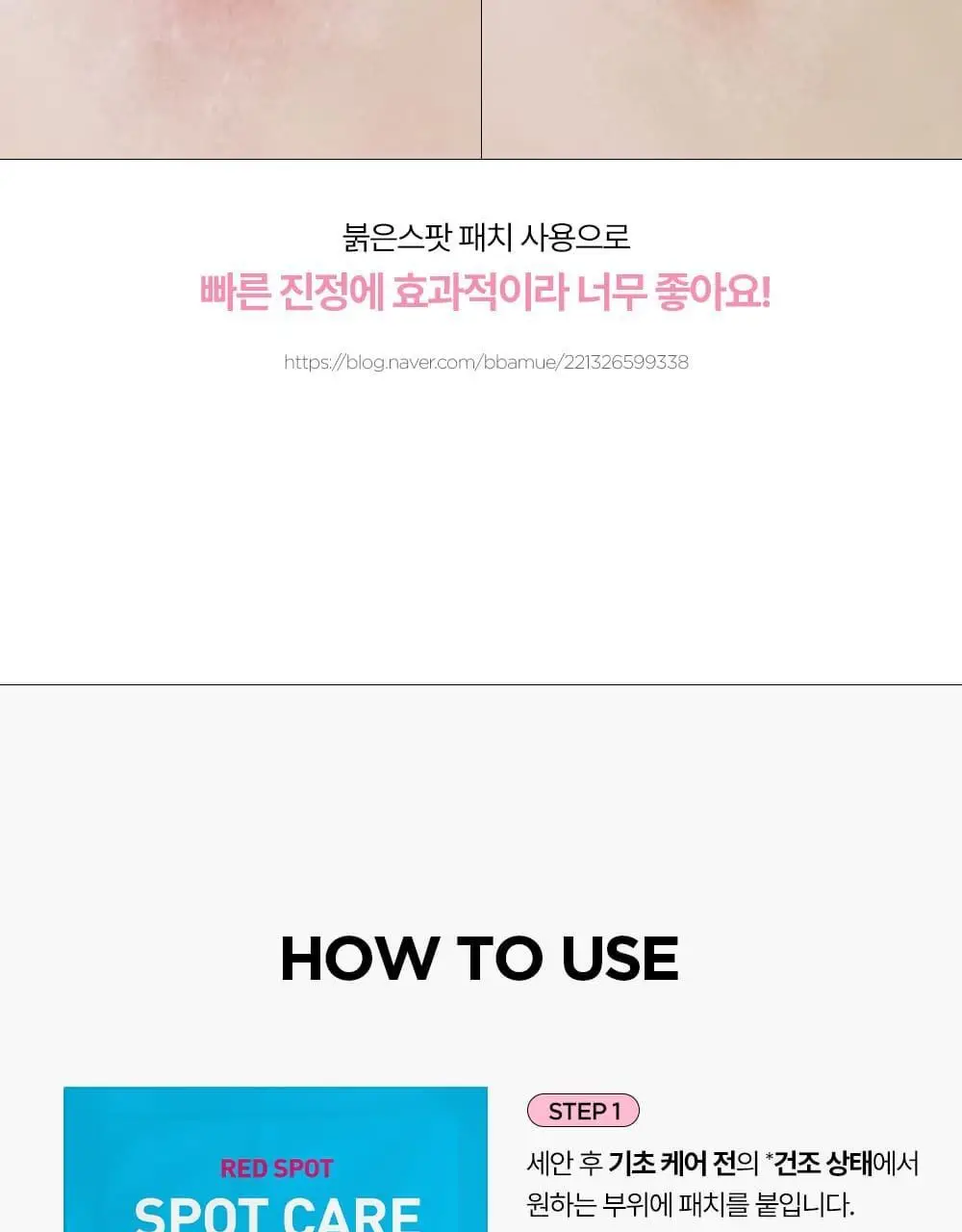 [올영단독기획 / 짜기 전/후 구성] 해서린 스팟케어 패치 키트 대용량 기획 140매 상세페이지 24